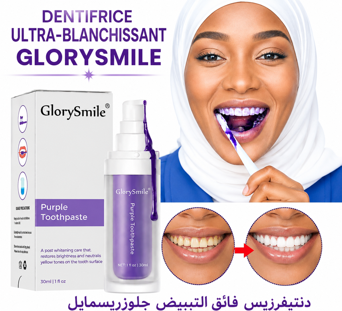 Dentifrice ultra-blanchissant Glorysmile